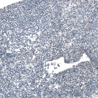 Immunohistochemical staining of human tonsil shows no positivity in non-germinal center cells as expected.