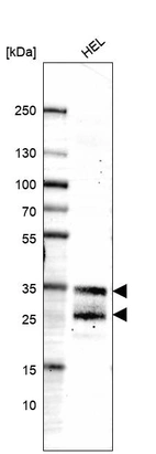 Western blot analysis in human cell line HEL.