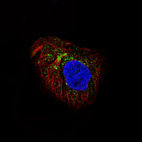 Immunofluorescence staining of A-431 cells using the Anti-LAPTM4B monoclonal antibody, showing specific staining in vesicles and the golgi apparatus in green. Microtubule- and nuclear probes are visualized in red and blue, respectively (where available).