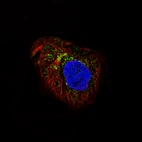 Immunofluorescence staining of A-431 cells using the Anti-LAPTM4B monoclonal antibody, showing specific staining in vesicles and the golgi apparatus in green. Microtubule- and nuclear probes are visualized in red and blue, respectively (where available).