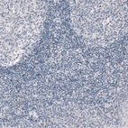 Immunohistochemical staining of human tonsil shows no positivity in non-germinal center cells as expected.