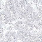 Anti-PCP4 Antibody