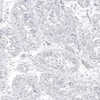 Immunohistochemical staining of human testis shows no positivity in cells in seminiferous ducts as expected.