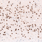 Anti-FOXP2 Antibody