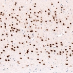 Immunohistochemical staining of mouse cerebral cortex shows strong nuclear positivity in layer 6 neurons.