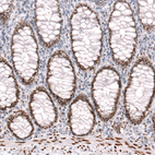 Anti-FOXP2 Antibody