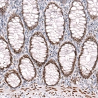 Immunohistochemical staining of human rectum shows strong nuclear positivity in glandular cells.