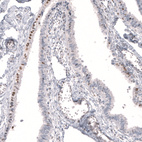 Anti-FOXP2 Antibody