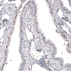 Immunohistochemical staining of human fallopian tube shows weak to moderate nuclear positivity in glandular cells.