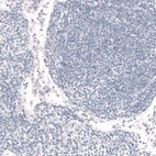 Immunohistochemical staining of human lymph node shows no positivity in non-germinal center cells as expected.