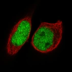 Immunofluorescence staining of RH-30 cells using the Anti-FOXP2 monoclonal antibody, showing specific staining in the nucleoplasm in green. Microtubule- and nuclear probes are visualized in red and blue, respectively (where available).