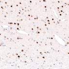 Anti-FOXP2 Antibody