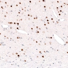 Immunohistochemical staining of rat cerebral cortex shows strong nuclear positivity in layer 6 neurons.