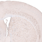 Immunohistochemical staining of mouse brain shows strong nuclear positivity in layer 6 cortical neurons, as well as in neurons in caudato-putamen.