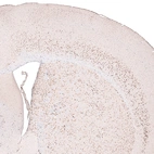 Immunohistochemical staining of mouse brain shows strong nuclear positivity in layer 6 cortical neurons, as well as in neurons in caudato-putamen.