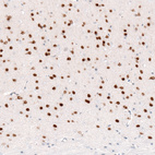 Immunohistochemical staining of mouse cerebral cortex shows strong nuclear positivity in layer 6 neurons.