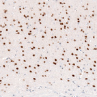 Anti-FOXP2 Antibody