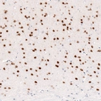 Immunohistochemical staining of mouse cerebral cortex shows strong nuclear positivity in layer 6 neurons.