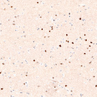 Immunohistochemical staining of human cerebral cortex shows strong nuclear positivity in layer 6 neurons.