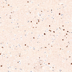 Anti-FOXP2 Antibody