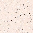 Immunohistochemical staining of human cerebral cortex shows strong nuclear positivity in layer 6 neurons.