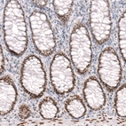 Immunohistochemical staining of human rectum shows moderate to strong nuclear positivity in glandular cells.
