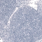 Immunohistochemical staining of human lymph node shows no positivity in non-germinal center cells as expected.