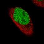 Immunofluorescence staining of RH-30 cells using the Anti-FOXP2 monoclonal antibody, showing specific staining in the nucleoplasm in green. Microtubule- and nuclear probes are visualized in red and blue, respectively (where available).