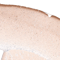 Anti-RELN Antibody