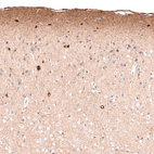 Immunohistochemical staining of mouse cerebral cortex shows immunoreactivity in the neuropil of layer 1, as well as cytoplasmic positivity in a subset of neurons in various layers.