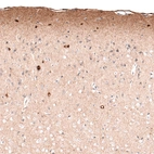 Immunohistochemical staining of mouse cerebral cortex shows immunoreactivity in the neuropil of layer 1, as well as cytoplasmic positivity in a subset of neurons in various layers.