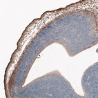 Immunohistochemical staining of mouse embryo E11 shows strong positivity in cells in the outer layer of developing cortical plate.