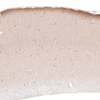 Immunohistochemical staining of rat cerebral cortex shows immunoreactivity in the neuropil of layer 1, as well as cytoplasmic positivity in a subset of neurons in various layers.