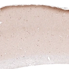 Immunohistochemical staining of rat cerebral cortex shows immunoreactivity in the neuropil of layer 1, as well as cytoplasmic positivity in a subset of neurons in various layers.