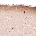 Immunohistochemical staining of rat cerebral cortex shows immunoreactivity in the neuropil of layer 1, as well as cytoplasmic positivity in a subset of neurons in various layers.