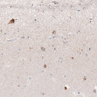 Immunohistochemical staining of human cerebral cortex shows moderate cytoplasmic positivity in a subset of neurons in layer 1.