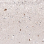 Immunohistochemical staining of human cerebral cortex shows moderate cytoplasmic positivity in a subset of neurons in layer 1.