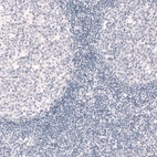 Immunohistochemical staining of human tonsil shows no positivity in lymphoid cells as expected (negative control).