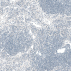 Immunohistochemical staining of human lymph node shows no positivity in non-germinal center cells as expected.