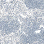 Anti-CTGF Antibody