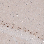 Immunohistochemical staining of mouse cerebral cortex shows strong cytoplasmic positivity in layer 6b neurons.