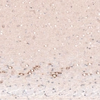 Immunohistochemical staining of rat cerebral cortex shows strong cytoplasmic positivity in layer 6b neurons.