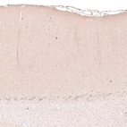 Immunohistochemical staining of rat cerebral cortex shows strong cytoplasmic positivity in layer 6b neurons.