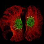 Anti-KMT2D Antibody