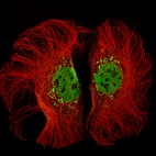 Anti-KMT2D Antibody