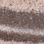 Immunohistochemical staining of human cerebellum shows positivity in a subset of neurons.