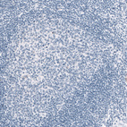 Immunohistochemical staining of human tonsil shows absence of positivity in lymphoid cells as expected (negative control).