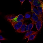 Immunofluorescence staining of SH-SY5Y cells using the Anti-MAP2 monoclonal antibody, showing specific staining in the cytosol and in microtubules in green. Microtubule- and nuclear probes are visualized in red and blue, respectively (where available).