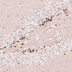 Immunohistochemical staining of mouse dentate gyrus shows strong nuclear positivity in a subset of neurons in the granular cell layer.