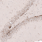 Immunohistochemical staining of rat dentate gyrus shows strong nuclear positivity in a subset of cells in granular layer.